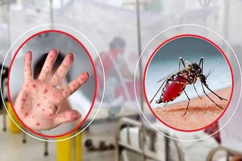 হামের উপসর্গে ৭ মৃত্যু, ডেঙ্গুতে তিন জনের